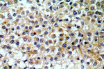 GPNMB Antibody in Immunohistochemistry (Paraffin) (IHC (P))