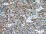 GPNMB Antibody in Immunohistochemistry (Paraffin) (IHC (P))