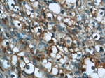 GPNMB Antibody in Immunohistochemistry (Paraffin) (IHC (P))