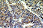 GPNMB Antibody in Immunohistochemistry (Paraffin) (IHC (P))