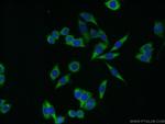 YBX1 Antibody in Immunocytochemistry (ICC/IF)