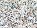 YBX1 Antibody in Immunohistochemistry (Paraffin) (IHC (P))