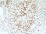 YBX1 Antibody in Immunohistochemistry (Paraffin) (IHC (P))