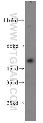 YBX1 Antibody in Western Blot (WB)