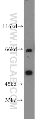 YBX1 Antibody in Western Blot (WB)