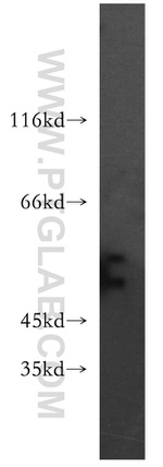 SLC18A1 Antibody in Western Blot (WB)