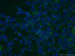 SMEK2 Antibody in Immunocytochemistry (ICC/IF)