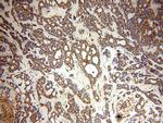 SMEK2 Antibody in Immunohistochemistry (Paraffin) (IHC (P))