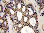 SMEK2 Antibody in Immunohistochemistry (Paraffin) (IHC (P))