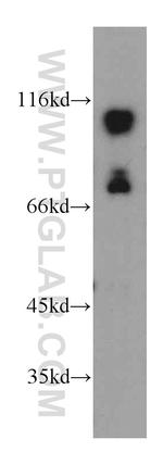 SMEK2 Antibody in Western Blot (WB)