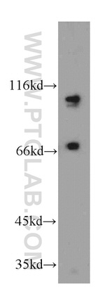 SMEK2 Antibody in Western Blot (WB)