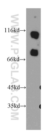 SMEK2 Antibody in Western Blot (WB)