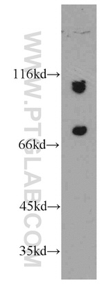 SMEK2 Antibody in Western Blot (WB)