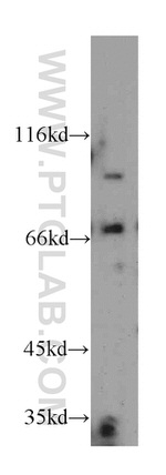 PKNOX2 Antibody in Western Blot (WB)