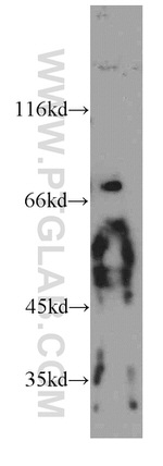 PKNOX2 Antibody in Western Blot (WB)