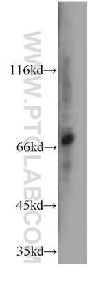 PKNOX2 Antibody in Western Blot (WB)