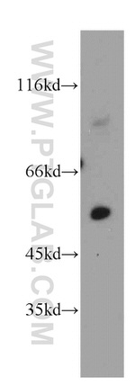 PKNOX2 Antibody in Western Blot (WB)