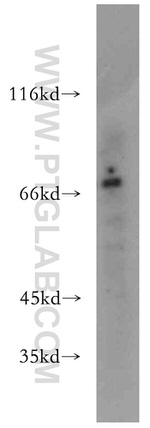 PKNOX2 Antibody in Western Blot (WB)