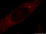 TRIM2 Antibody in Immunocytochemistry (ICC/IF)