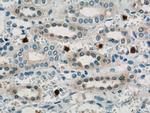 TRIM2 Antibody in Immunohistochemistry (Paraffin) (IHC (P))
