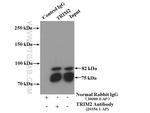 TRIM2 Antibody in Immunoprecipitation (IP)