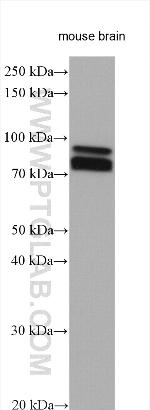TRIM2 Antibody in Western Blot (WB)