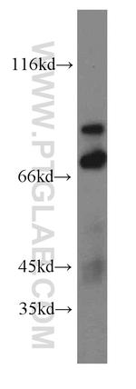 TRIM2 Antibody in Western Blot (WB)