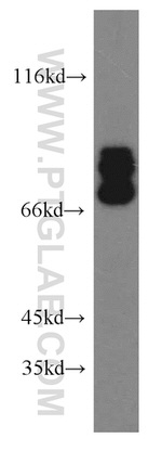 TRIM2 Antibody in Western Blot (WB)