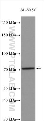 Secretogranin II Antibody in Western Blot (WB)