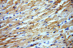 MYOM1 Antibody in Immunohistochemistry (Paraffin) (IHC (P))