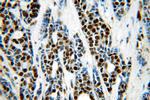 RBAP48 Antibody in Immunohistochemistry (Paraffin) (IHC (P))