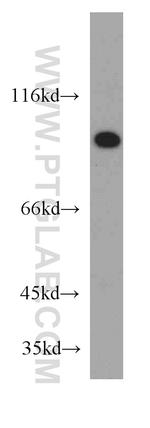 SUZ12 Antibody in Western Blot (WB)