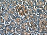 PHD2 Antibody in Immunohistochemistry (Paraffin) (IHC (P))
