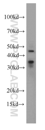 PHD2 Antibody in Western Blot (WB)