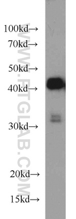 PHD2 Antibody in Western Blot (WB)