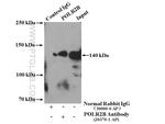POLR2B Antibody in Immunoprecipitation (IP)