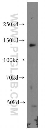 POLR2B Antibody in Western Blot (WB)