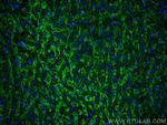 AQP9 Antibody in Immunohistochemistry (PFA fixed) (IHC (PFA))