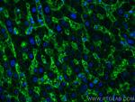 AQP9 Antibody in Immunohistochemistry (PFA fixed) (IHC (PFA))