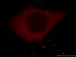 ATG4C Antibody in Immunocytochemistry (ICC/IF)