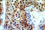 ATG4C Antibody in Immunohistochemistry (Paraffin) (IHC (P))