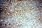 ATG4C Antibody in Immunohistochemistry (Paraffin) (IHC (P))