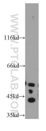 PECI Antibody in Western Blot (WB)