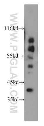 PECI Antibody in Western Blot (WB)