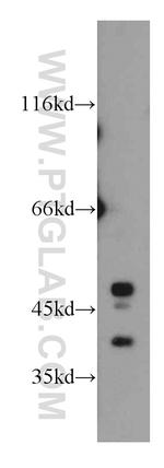 PECI Antibody in Western Blot (WB)