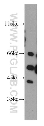 PECI Antibody in Western Blot (WB)