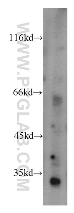 NPHS2 Antibody in Western Blot (WB)