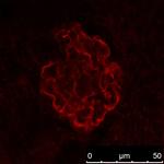 NPHS2 Antibody in Immunohistochemistry (IHC)