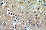 CLN3 Antibody in Immunohistochemistry (Paraffin) (IHC (P))