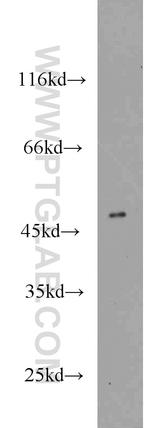 CLN3 Antibody in Western Blot (WB)